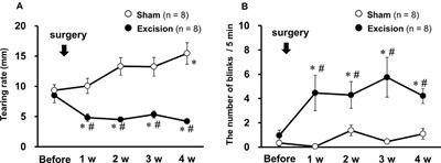 Chronic Tear Deficiency Sensitizes Transient Receptor Potential Vanilloid 1-Mediated Responses in Corneal Sensory Nerves